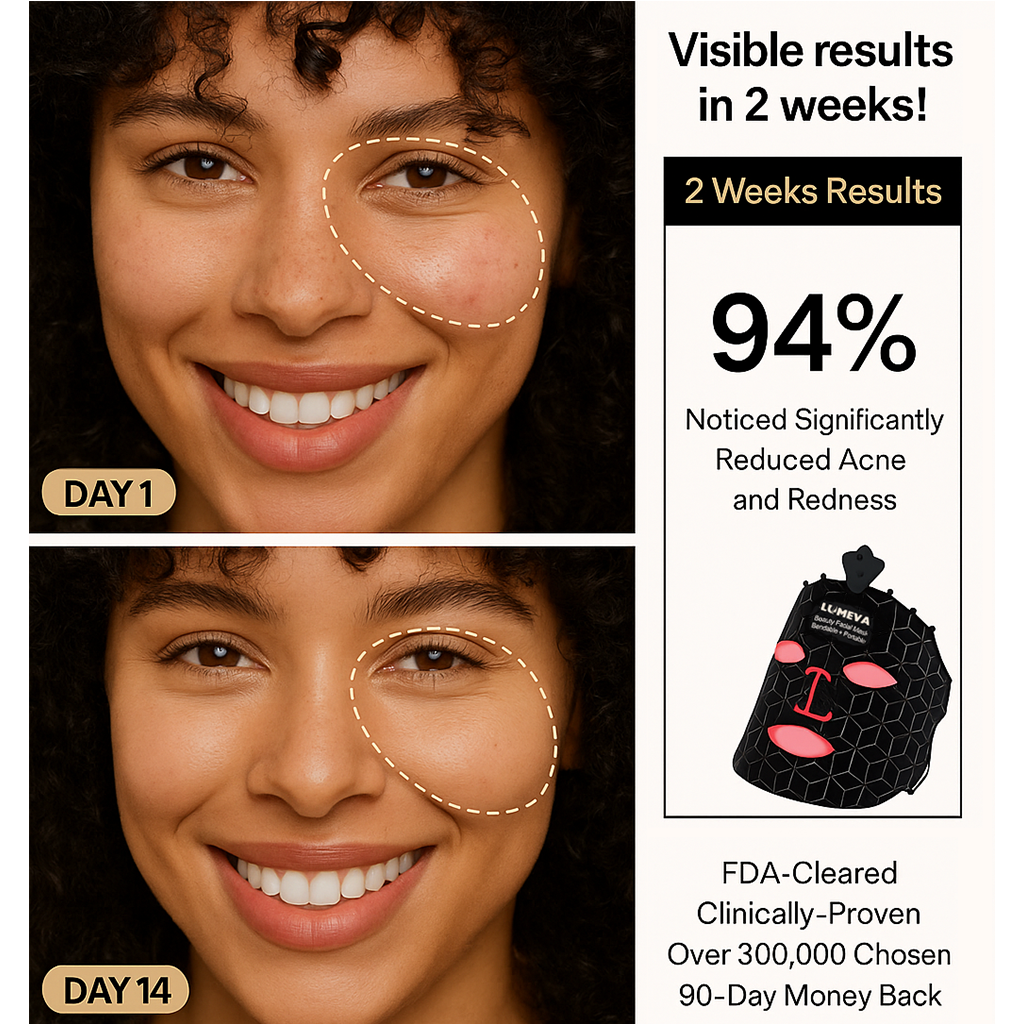 LUMEVA™ LED Light Therapy Mask